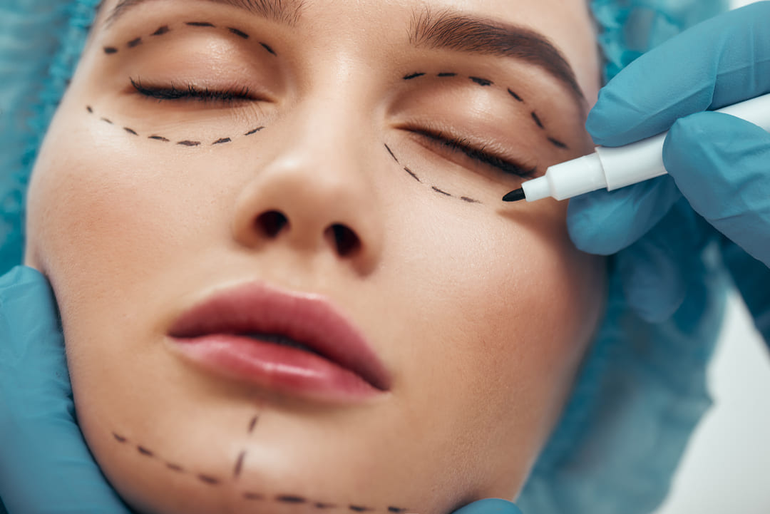 A Importância da Avaliação Prévia na Harmonização Facial